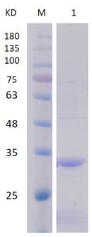 12% SDS-PAGE analysis profiles of purified PA1302-31-259 (CBB stained).